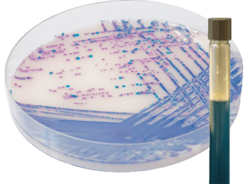 medio de cultivo salmonella