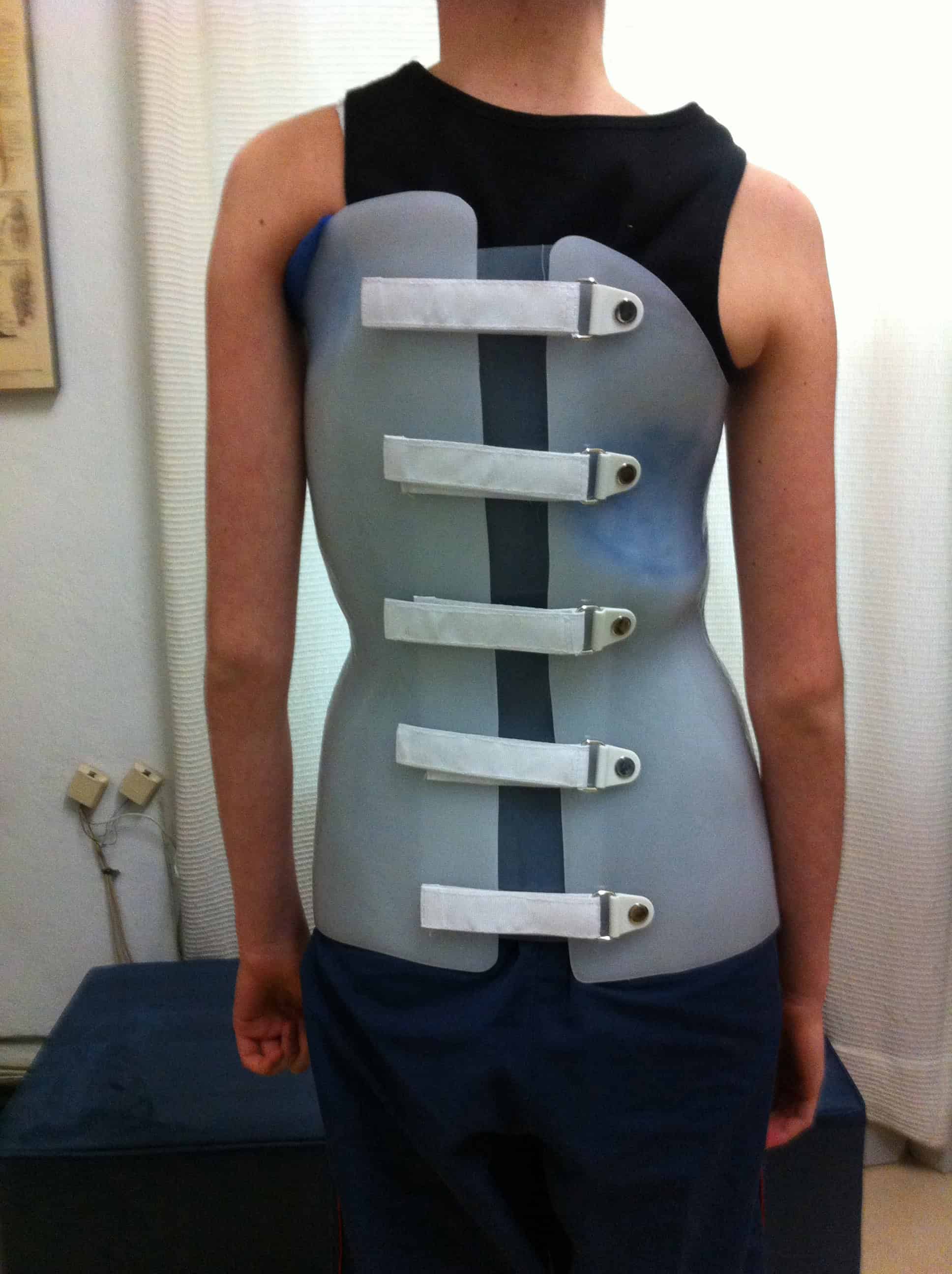 Corseteria ortopedica - Laboratorio de Ortomedica