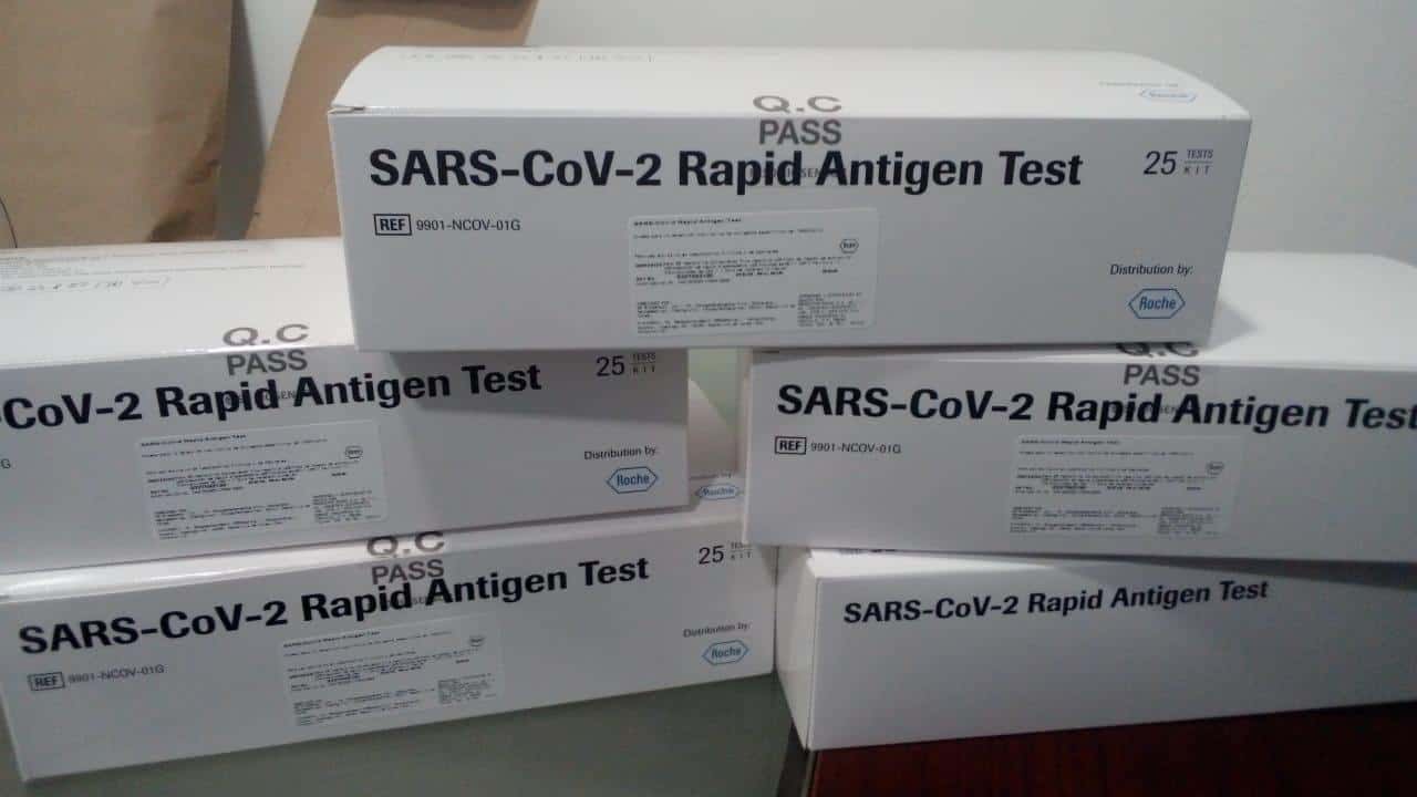 Prueba rapida de antigeno covid-19 - Diaserlab
