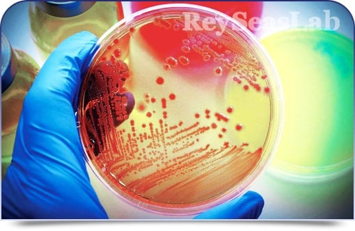 Analisis microbiologicos - ReyseasLab