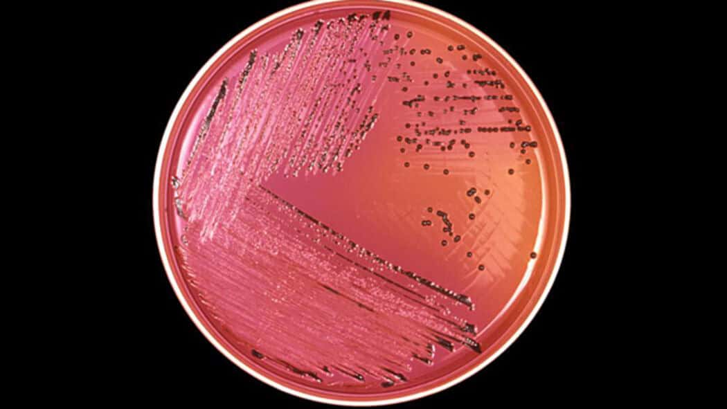 Medio de cultivo para salmonella