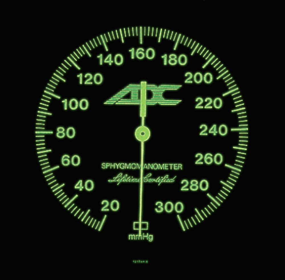 Manómetro estilo reloj con un dial luminiscente de 6” grande y fácil de leer para una alta visibilidad en prácticamente cualquier condición de luz