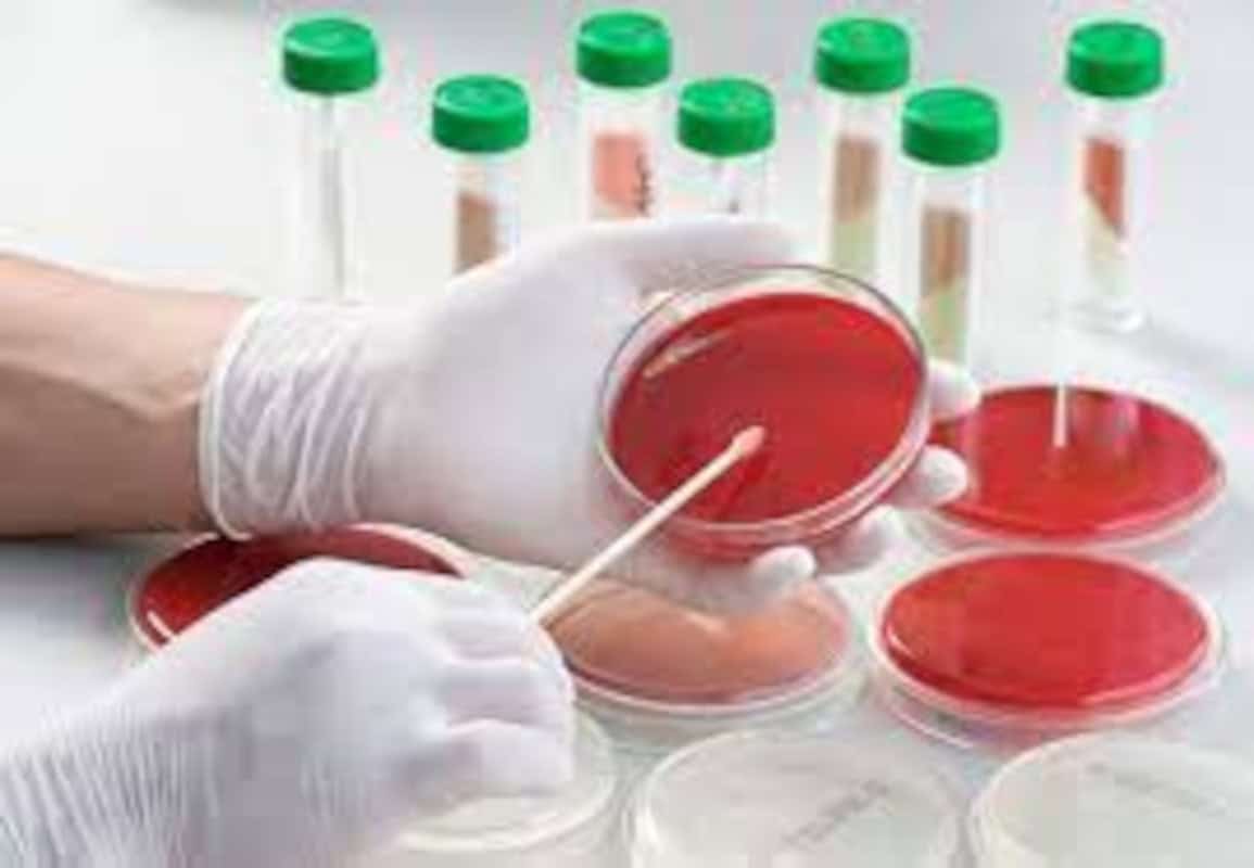 Pruebas Rápidas para Patógenos 1