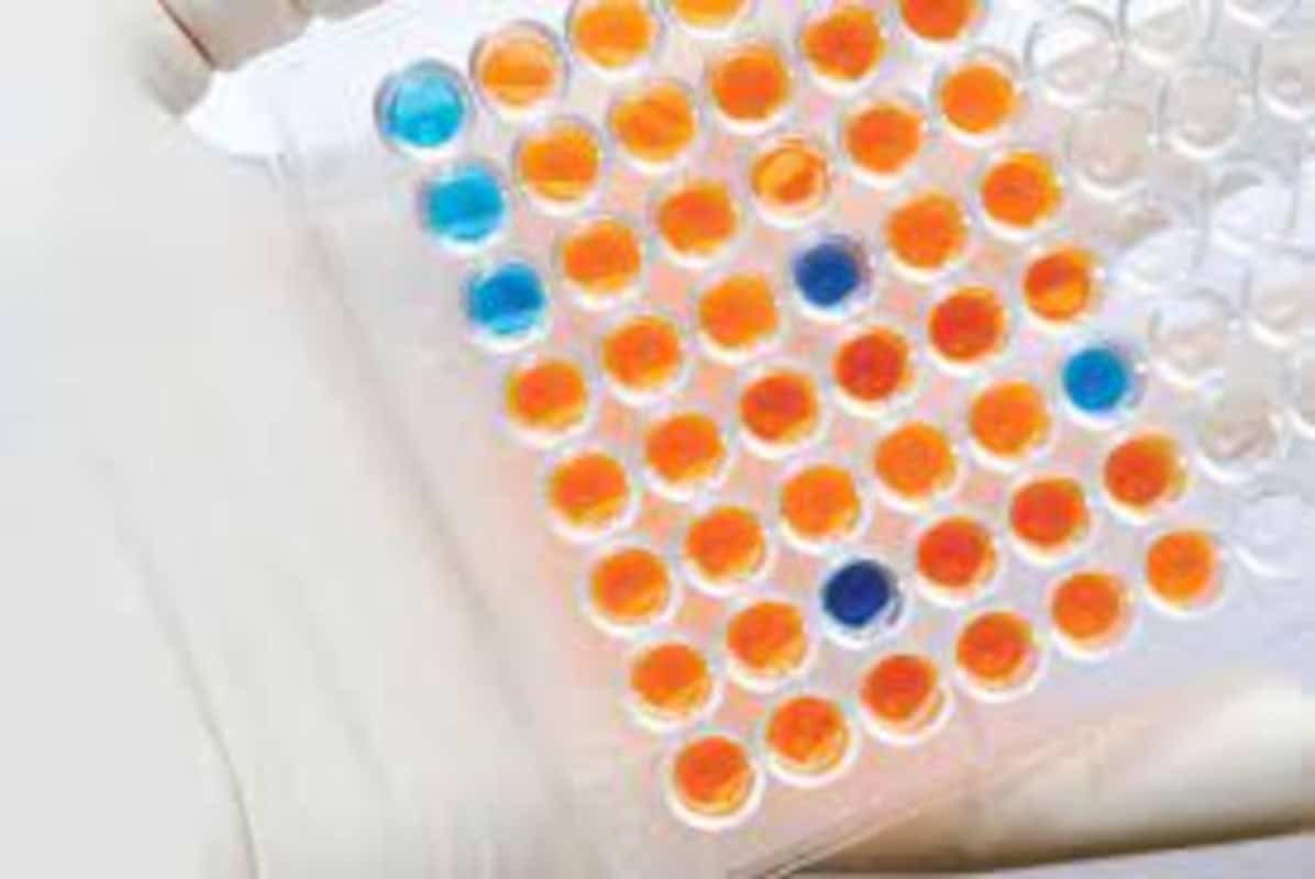 Pruebas Rápidas Microbiología 1