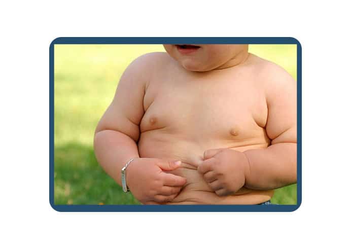 Servicios pediatricos Obesidad