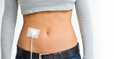 Equipo para Diálisis Peritoneal Automatizado