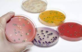 Listeria monocytogenes en placas