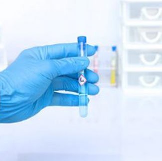 Sulfato de cobre Grado Analítico