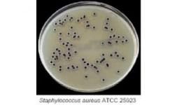 Agar Baird Parker Merck-Sigma para recuento microbiológico de Staphylococcus aureus en México