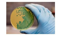 Agar agar para bacteriologia