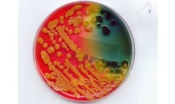 Agar bacteriologico - AIG Sinergia y Representaciones