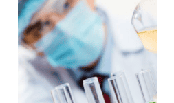 Cromatografos de gases - Reactivos y Seguridad Industrial