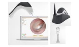 Video otoscopios - Instrumentación de Audiología y Medicina del Trabajo