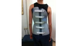 Corseteria ortopedica - Laboratorio de Ortomedica