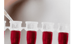 Ácido fluorosílicico para purificación de plomo 