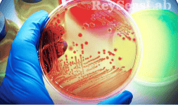 Analisis microbiologicos - ReyseasLab