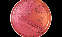 Medios de cultivo para salmonella