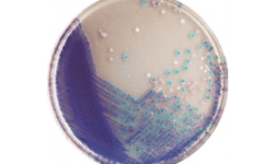 Agar cromogénico para Salmonella acorde a la NOM-210 en México