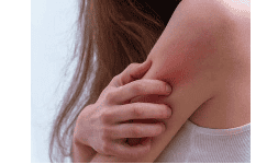 Carboximetil Celulosa de Sodio contra Irritaciones