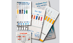 Prueba Antidoping