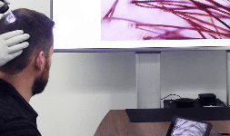 Microscopios digitales Dino-Lite PARA SPA tratamientos 
