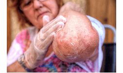 Sanitizantes Aquaclean Premium