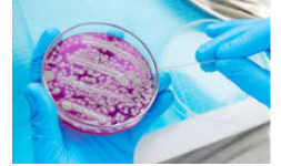 Laboratorios de análisis de alimentos acreditados EMA en Aguascalientes
