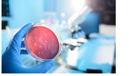 Laboratorios de análisis de alimentos acreditados EMA en Puebla