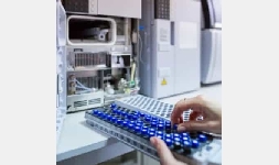 Cromatógrafos HPLC Young In Chromass